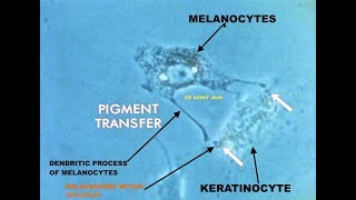 Pigment transfer in Skin cells Melanosome transfer from MELANOCYTE to KERATINOCYTE I Dr Somit Jain [upl. by Adyahs]