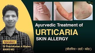 Allergic Skin Diseases treatment in Ayurved  Dr Pravinkumar A Mishra ayurved skin allergy [upl. by Slen]