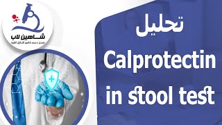 Calprotectin in stool test تحليل [upl. by Eniroc]