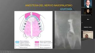 Técnicas anestésicas complejas en odontología [upl. by Kin]