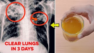 8 Ways To Detox Your Lungs Naturally  How To Clean Your Lungs  फेफड़े साफ़ करने का तरीका [upl. by Trilly582]