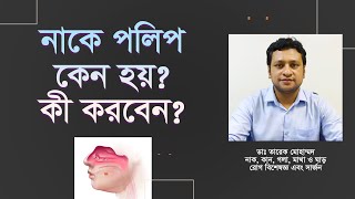 নাকে পলিপ কেন হয় ও কী করবেন [upl. by Kosse]