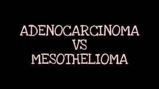 Adenocarcinoma Vs Mesothelioma of lungs Respiratory Pathology [upl. by Idissak921]