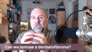 AskJJ Can we remove a dermatofibroma [upl. by Umeh451]