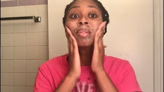 Glycolic Acid Peel DIY  Dark Spot Treatment [upl. by Perrin]