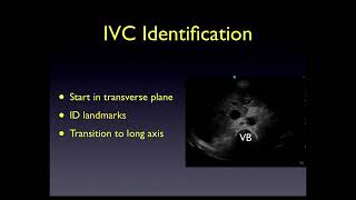 Inferior Vena Cava Ultrasound [upl. by Isla]