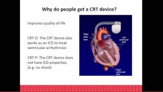 ICD overview [upl. by Peppie831]