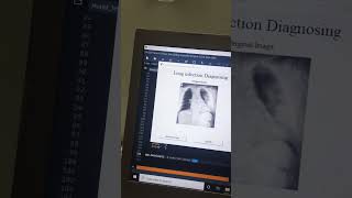 Classification of Infections in Lung XRay Images using the Resnet50 Model [upl. by Ogilvie510]