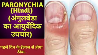 Paronychia finger nail infection in Hindi  पेरोनिसिया नाखूनों का संक्रमण  अंगुलबेडा घरेलू उपचार [upl. by Nace]