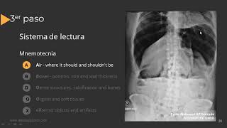 Radiografía de Abdomen Paso a Paso [upl. by Niko]