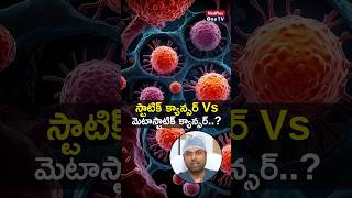 Static vs Metastatic Cancer Difference l Dr Pavan Kumar Jonnada shorts MedPlusONETV [upl. by Llevron125]