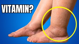 1 Vitamin to Eliminate Swelling in Feet and Legs [upl. by Aiouqahs847]