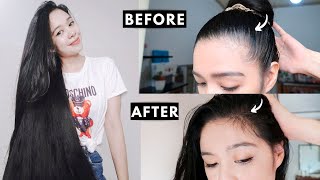 How I Grew Back My Hairline amp Prevent Receding Hairline [upl. by Tnomad499]