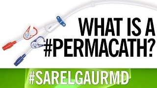 What is a Permacath [upl. by Toombs]