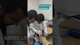 Intubation procedure endotracheal intubation shorts doctorslife medical mbbs [upl. by Klarrisa]