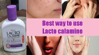 Lecto Calamine Lotion UsesBest 5 Way to Use On SkinNo More Dry pigmentedItcy Skin [upl. by Trebled139]