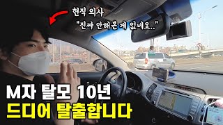 M자 탈모 저는 이것과 모발이식에 투자했습니다 feat 모발이식 후기 [upl. by Phil]