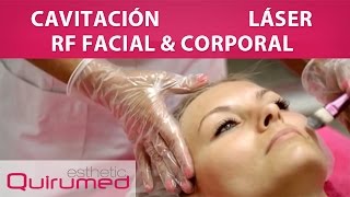 Cavitación  Radiofrecuencia Facial y Corporal  Láser [upl. by Ahsitnauq]