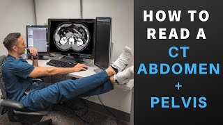 Radiology How to Read a CT Abdomen amp Pelvis My search pattern [upl. by Perseus979]