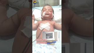 This baby convulsion treatment🩺💉 newbornbaby amazingbaby babyvideo shorts kids baby doctor [upl. by Broida]