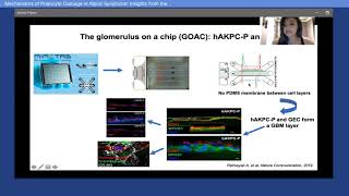 Mechanisms of Podocyte Damage in Alport Syndrome Insights from the Alportonachip System [upl. by Ivens]