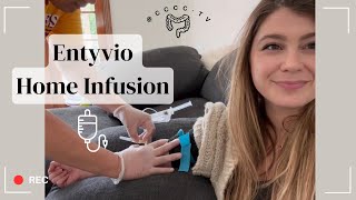 Home Infusion of Entyvio for Ulcerative Colitis [upl. by Hagar906]