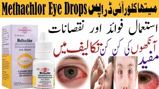 Methachlor Eye Drops PriceUsesBenefitsSide Effects Redness of Eye Swelling in eye [upl. by Adnoel967]