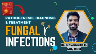 FUNGAL INFECTIONS  Pathogenesis  Diagnosis  Treatment  Harrison [upl. by Eira622]