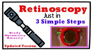 Updated Retinoscopy just in 3 Simple Steps [upl. by Hayimas366]