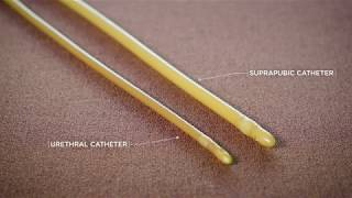 What Is a Suprapubic Catheter [upl. by Katerina185]