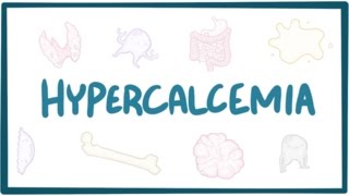 Hypercalcemia  causes symptoms diagnosis treatment pathology [upl. by Brucie]