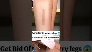 Get rid of strawberry legs amp hands diy organicbeauty skincare strawberry skinwhitening [upl. by Orecul7]