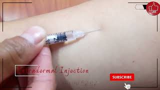 Intradermal Injection [upl. by Nadabas]