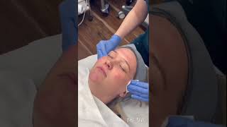 Have You Heard of A MANDELIC PEEL LEARN MORE ABOUT IT skincare treatment viralvideo shorts [upl. by Selry]