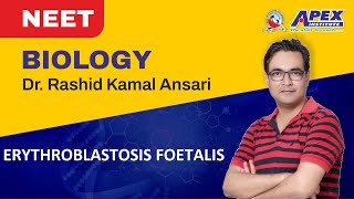 Erythroblastosis foetalis  NEET Biology Dr Rashid Kamal RAKA SIR Apex Institute Prayagraj [upl. by Simah]