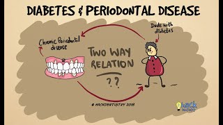 Diabetes and periodontitis The two way relationship [upl. by Dric]