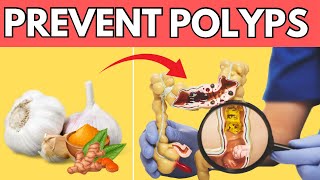 Top 9 Miracle Foods to Prevent Polyps and Colon Cancer [upl. by Petta]