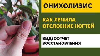 Онихолизис отслоение ногтевой пластины от ложа лечение как лечить [upl. by Broddie]