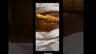 Wood therapy asmr woodtherapy massage asmrsounds [upl. by Idnam]