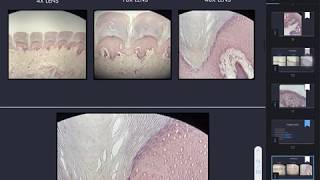 Keratinized stratified nonkeratinized stratified and transitional epithelium [upl. by Emyam264]