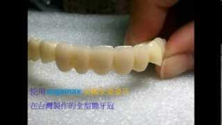 Sagemax美國全瓷瓷牙 sagemax NexxZr T Zirconia 氧化鋯瓷塊瓷牙 [upl. by Ainollopa]