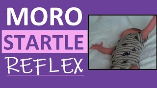 Moro Reflex Newborn Test  Startle Reflex  Pediatric Nursing Assessment [upl. by Ahsac]