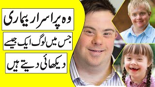 The Causes of Down Syndrome in Urdu Hindi [upl. by Erotavlas]