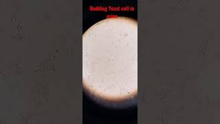 Urine Microscopy Budding yeast cell and pus cell WBCs in Urine Urine Analysis [upl. by Asillim]