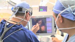 The Deep Brain Stimulation DBS Journey  Short Version [upl. by Tamis636]