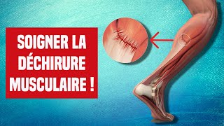 SOIGNER UNE DÉCHIRURE MUSCULAIRE  EXPLICATION ET TRAITEMENT [upl. by Ymas326]