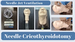 How to do Needle Cricothyroidotomy  Needle Jet Ventilation [upl. by Weylin]