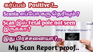 Anembryonic pregnancy in tamil  blighted ovum in tamil  early pregnancy at 6 week in tamil [upl. by Ivar]