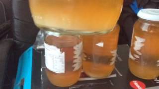 Sediment and Kidney Filtration Urine Samples [upl. by Venezia348]