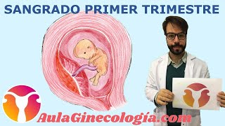 SANGRADO PRIMER TRIMESTRE Diagnóstico diferencial causas ecografía  Ginecología y Obstetricia [upl. by Safir]